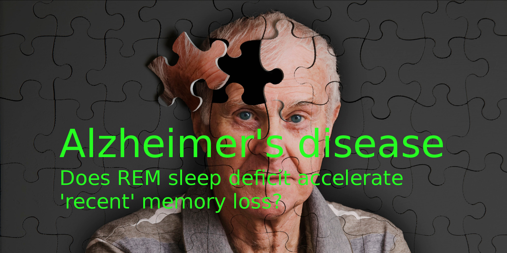 Alzheimer’s disease: possible connection to REM sleep deficit